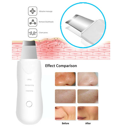 17056 1b-006 limpiador Facial con vibración profunda 1 Pza